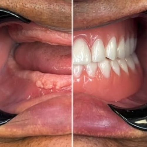 ????????????????????????????????